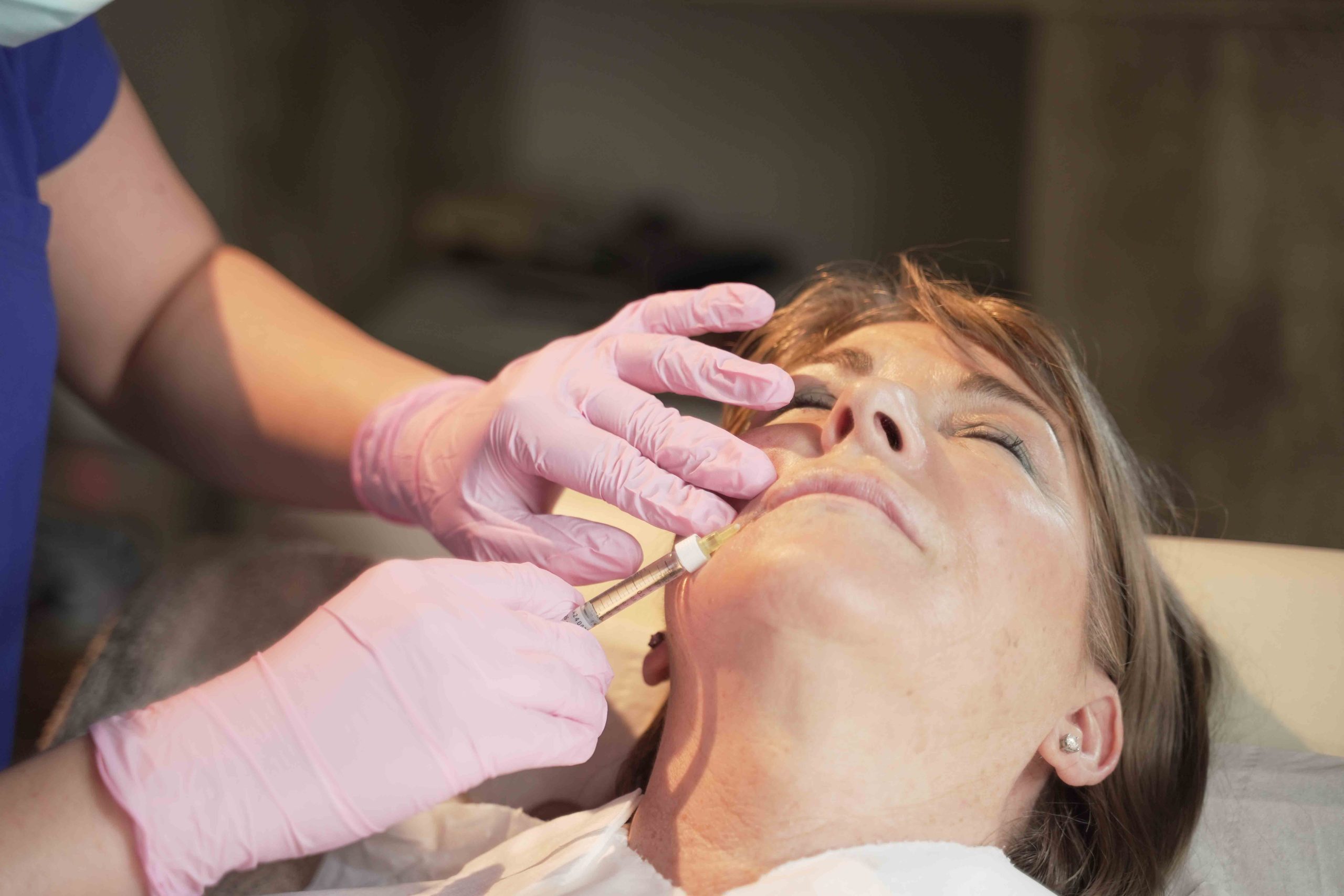 lip augmentation treatments in Tarporley Cheshire at Definity Aesthetics
